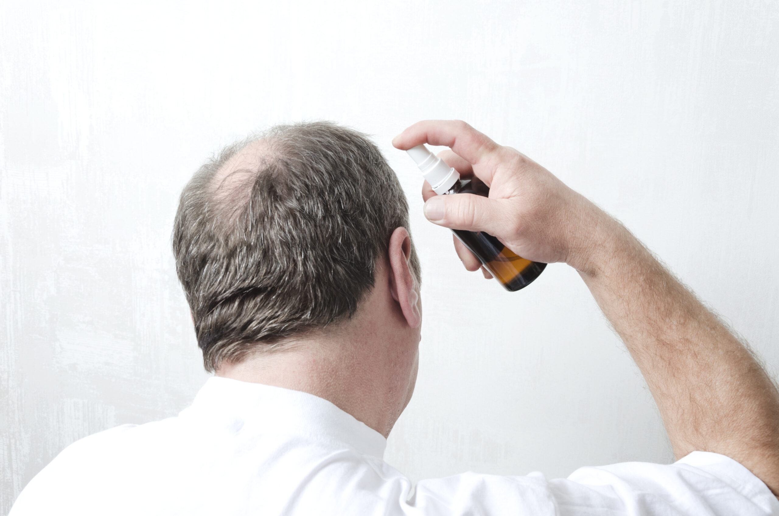 Man using topical finasteride