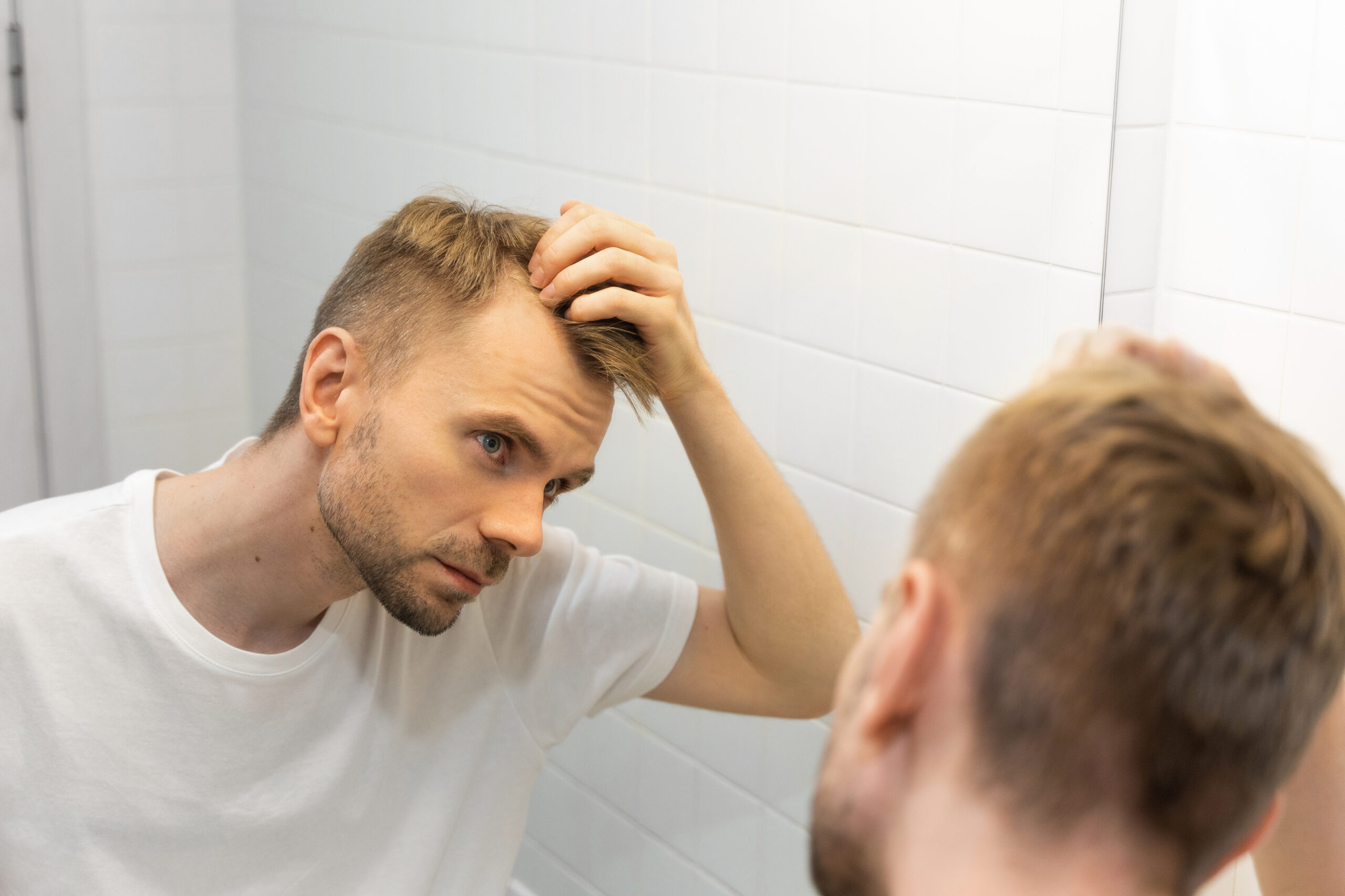 Man checking receding hairline in mirror