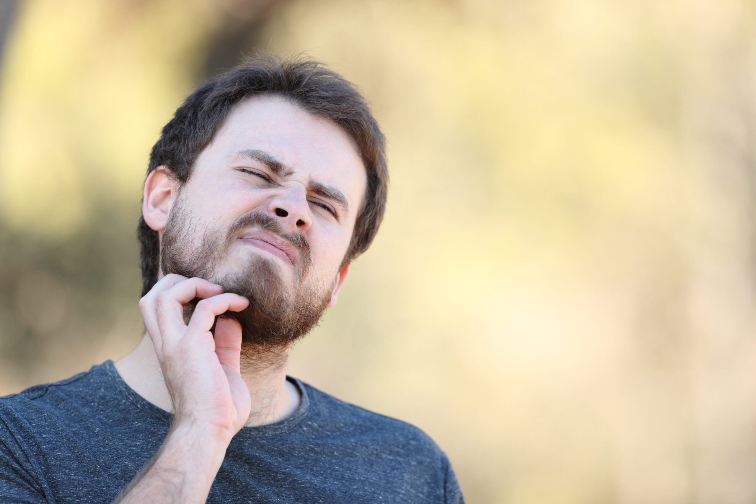 Man experiencing minoxidil beard side effects