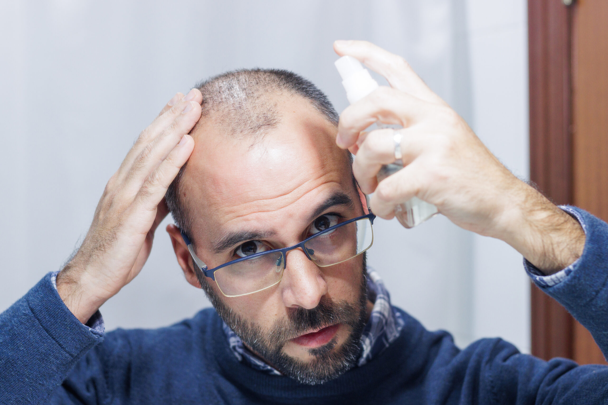 Man using topical hair growth medication