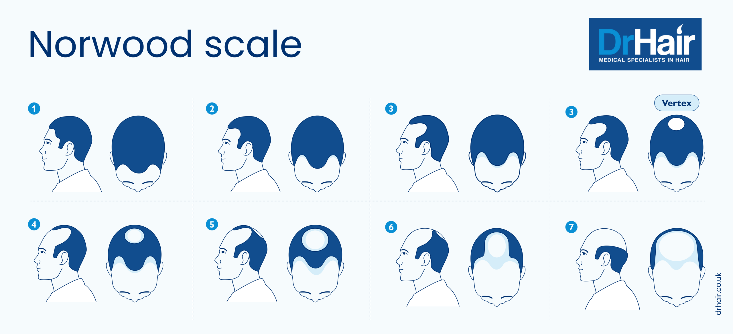 Norwood Scale